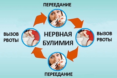 Лечение булимии в Ухте
